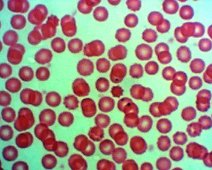 Menschliches Blut: Rote Blutkörperchen